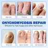 Nail Fungus Patch Waterproof Nail Repair Patch Ingrown Correction Sticker Damaged Nail Gray Care Patch Feet Care Tools